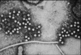 hepatitis E