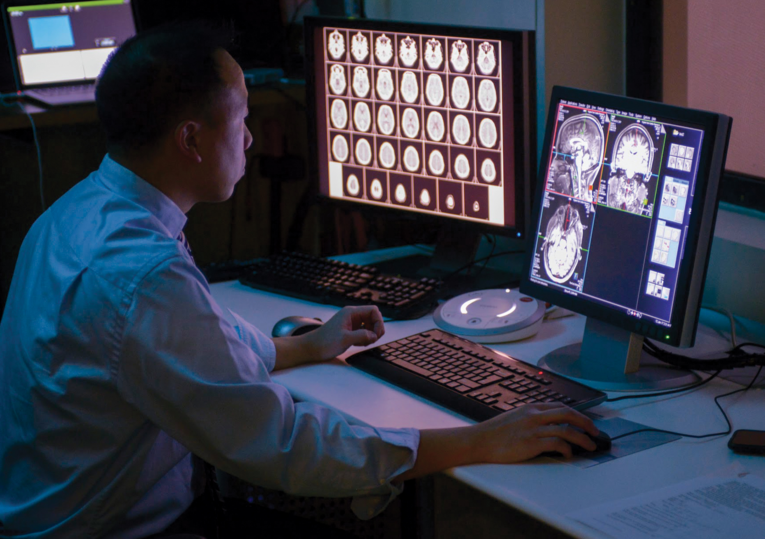 researcher looking at brain xrays